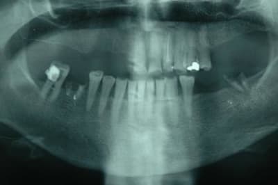 Photo 0001 gxjtb0 - Eugenol