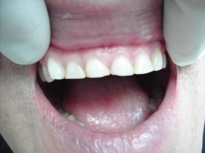 Photo 010 vfkqmy - Eugenol