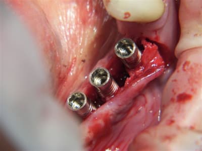 Photo 064  2  t7y8jz - Eugenol