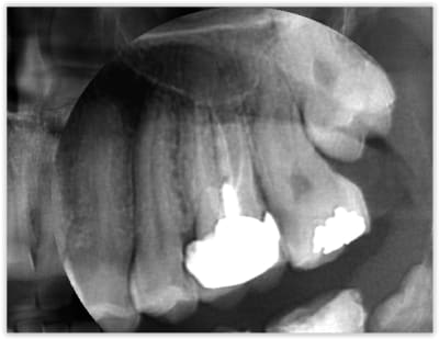 Photo 1 virtfa - Eugenol