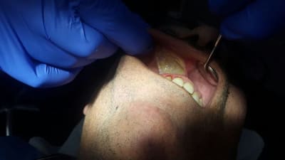 Photo 1 xxrzvp - Eugenol