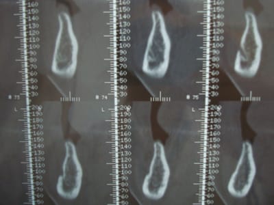 Photo 2751 ufqmrs - Eugenol