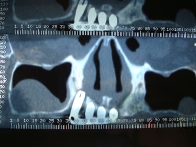 Photo 664 iceouq - Eugenol