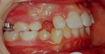 Picture1 d ctkpct - Eugenol