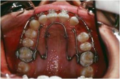 Picture4 ljcaoe - Eugenol