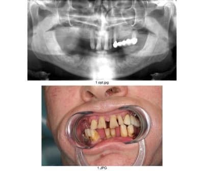 Planche contact 001 r8g1qu - Eugenol