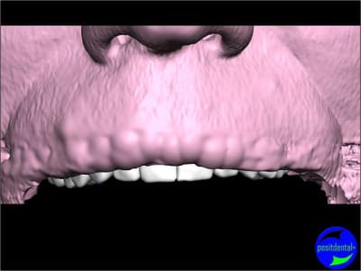 Positdental 001 vy35u9 - Eugenol