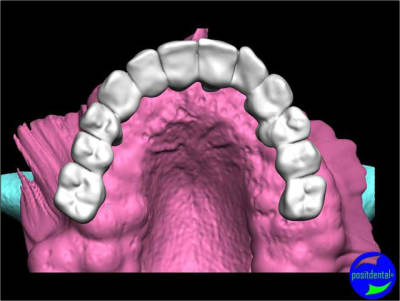 Positdental 008 twqkmv - Eugenol