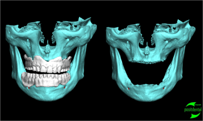 Positdental q5y8xc - Eugenol