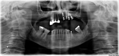 Pr2 rxbvke - Eugenol