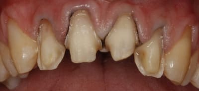 Preparation w1o4ul - Eugenol