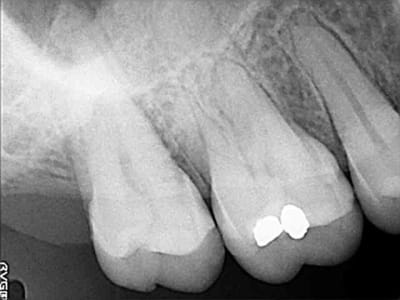 R1 - Eugenol