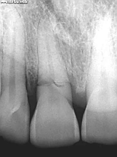 R12 kdecxw - Eugenol