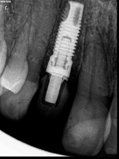 R12 xh8kwq - Eugenol