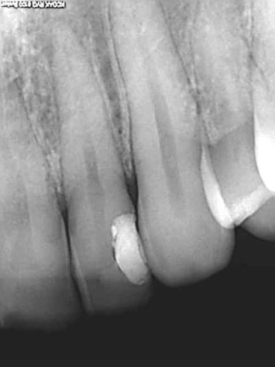 R15 i5bhok - Eugenol