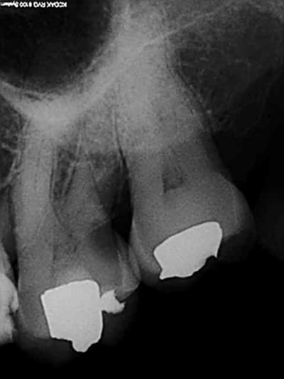 R1 ivtvsi - Eugenol