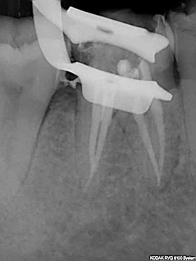 R3 qf7x03 - Eugenol