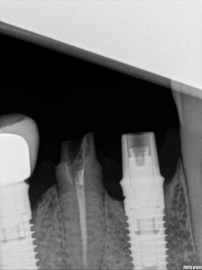 R41 fnrh7e - Eugenol