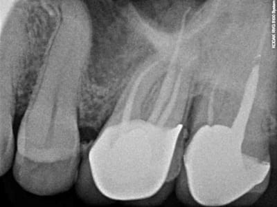 R42 h62zsf - Eugenol