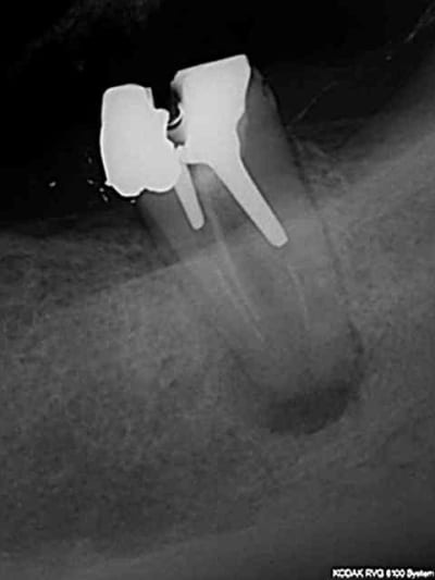 R60 ax1kth - Eugenol