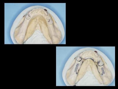 Raf 2 e5ocfk - Eugenol
