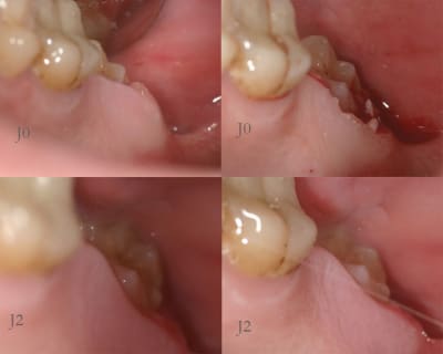 Recap zjzppq - Eugenol