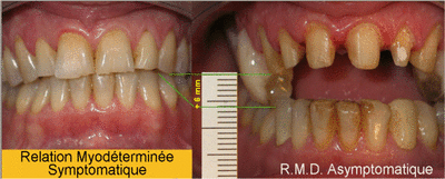 Rmds rmda wa3tfb - Eugenol