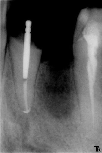 Rte 11 xup17w - Eugenol