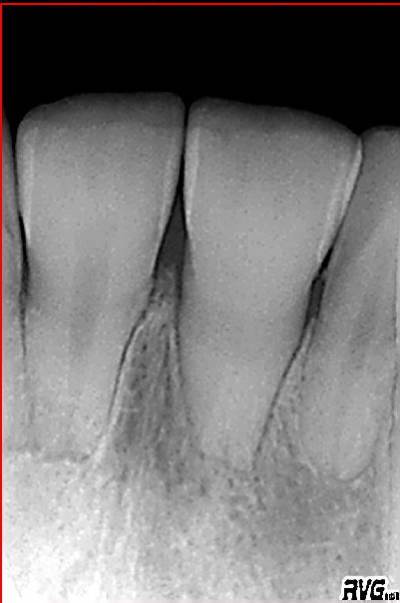 Rvg mpsox6 - Eugenol