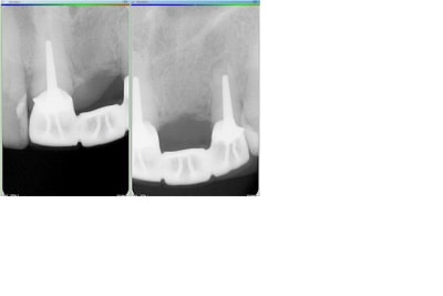 Rvg yn5gov - Eugenol