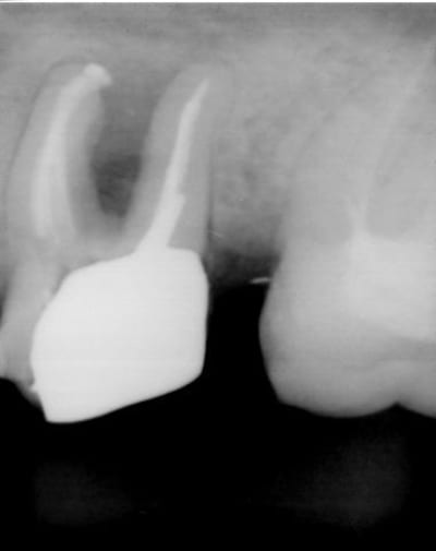 Rx apres jss66j - Eugenol