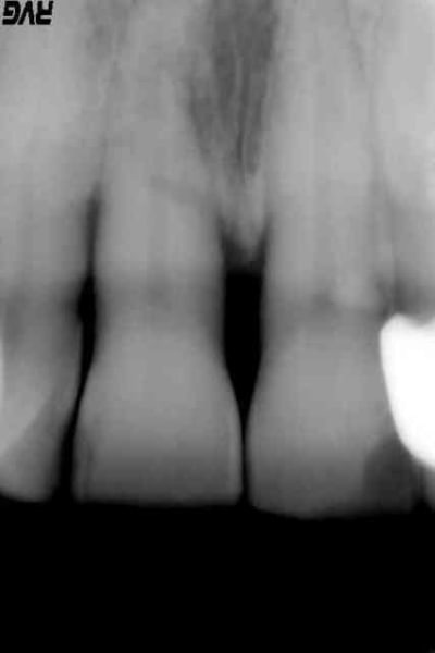 Rbor1 zi488q - Eugenol