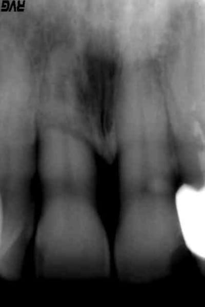 Rbor3 tck8uf - Eugenol