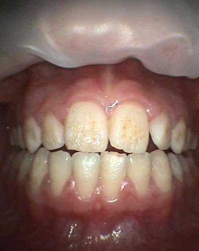 S15 vpfp8s - Eugenol