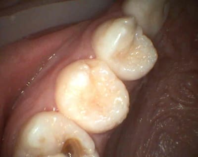 S6 wjensg - Eugenol