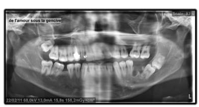 Sagesse e8vkbu - Eugenol