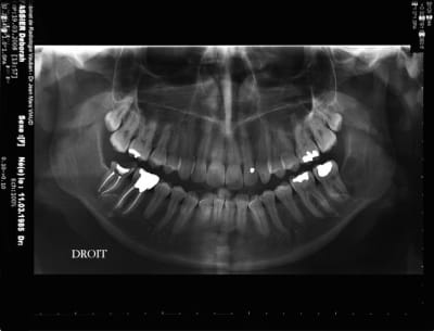 Sdim1090 nijlak - Eugenol