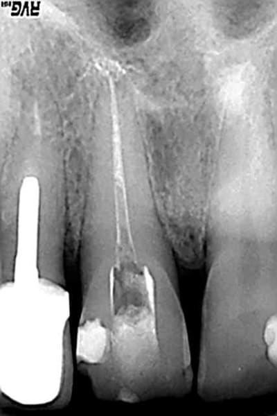 Sel2 gstbbq - Eugenol