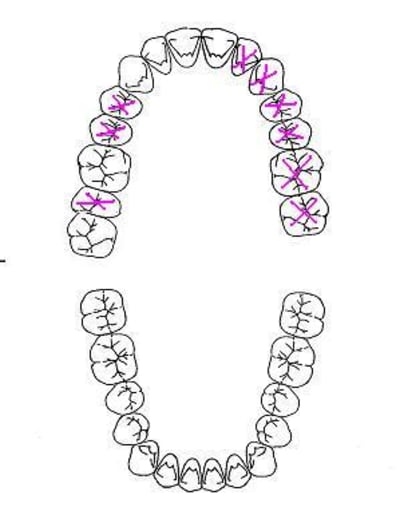 Ser2 sgpi1y - Eugenol