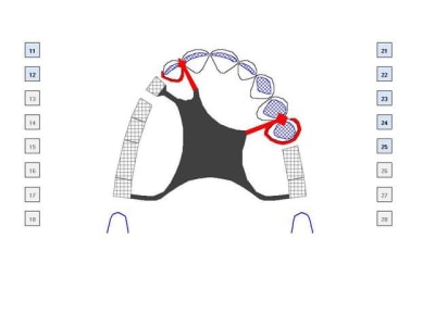 Spiff2 gzn1xi - Eugenol