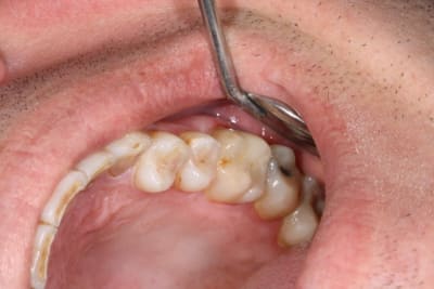 Sans titre 1 a91pkn - Eugenol