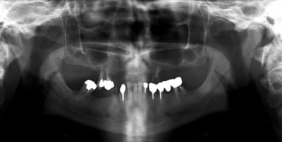 Sans titre 1 bbn3cq - Eugenol