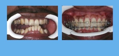 Sans titre 1 rcrz3y - Eugenol