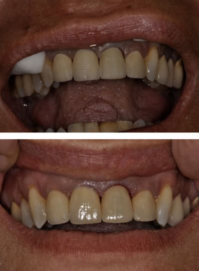 Sans titre 3 e4ns8a - Eugenol