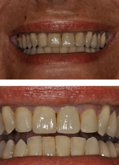 Sans titre 4 xsxrdf - Eugenol