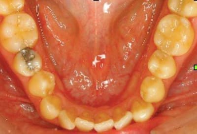 Sans titre 3 sa1pc5 - Eugenol