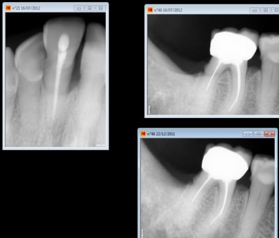 Sans titre bkmgv2 - Eugenol