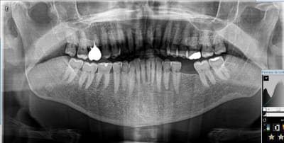 Sans titre h2ydc0 - Eugenol
