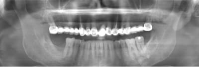 Sans titre immh3w - Eugenol