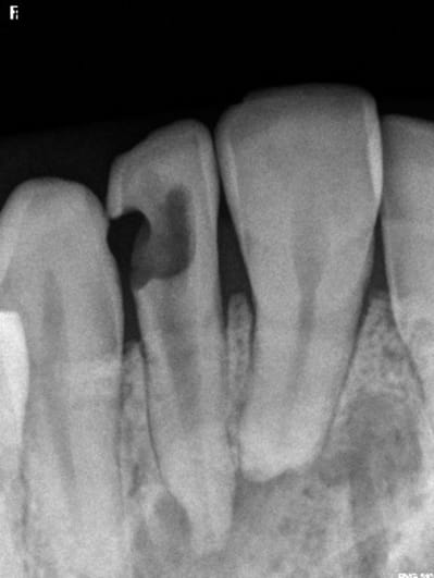 Sans titre nowhu1 - Eugenol